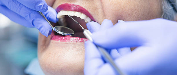 Best Walk-In Dentist Near Me  in Angels, CA